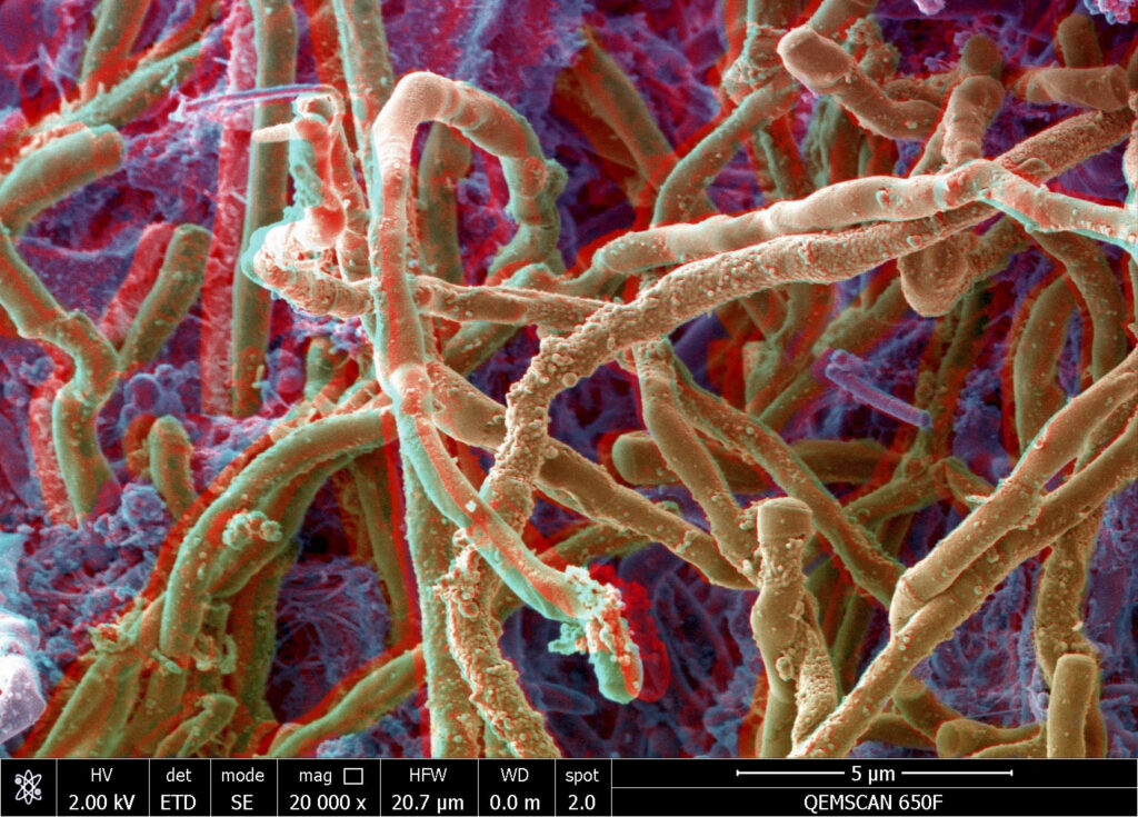 Explorando la Vida Microscópica de Nuestra Boca – Laboratorio de Imagen